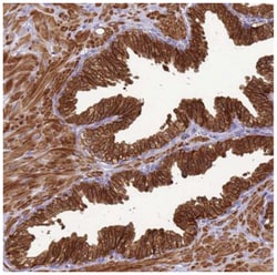KLHL9 Antibody, Novus Biologicals 25 &mu;L:Antibodies, Polyclonal