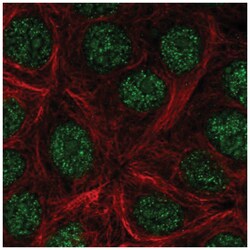KLLN Antibody, Novus Biologicals 100&mu;L; Unlabeled:Antibodies, Polyclonal