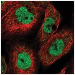 KMT2A/MLL Antibody, Novus Biologicals 100&mu;L; Unlabeled:Antibodies, Polyclonal