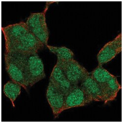 KMT3B/NSD1 Antibody, Novus Biologicals:Antibodies:Primary Antibodies