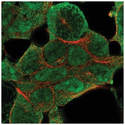 KMT3B/NSD1 Antibody, Novus Biologicals 25 &mu;L, Unlabeled:Antibodies,