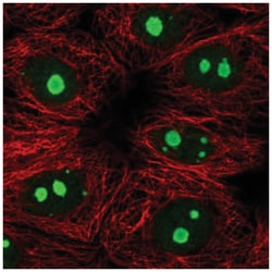 KNOP1 Antibody, Novus Biologicals 25 &mu;L:Antibodies, Polyclonal