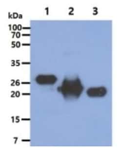 KRAS Mouse anti-Human, Clone: 2F8, Novus Biologicals:Antibodies:Primary