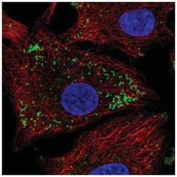 KRT222 Antibody, Novus Biologicals:Antibodies:Primary Antibodies