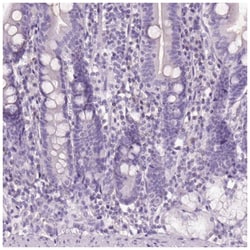 KRT25 Antibody, Novus Biologicals 100&mu;L; Unlabeled:Antibodies, Polyclonal