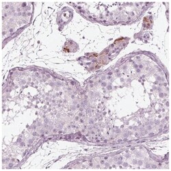 KRT28 Antibody, Novus Biologicals 100&mu;L; Unlabeled:Antibodies, Polyclonal