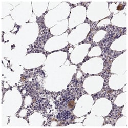 KRT81 Antibody, Novus Biologicals 25 &mu;L, Unlabeled:Antibodies, Polyclonal