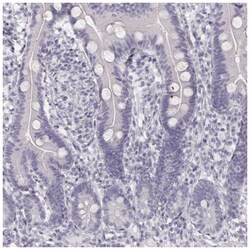 KRT82 Antibody, Novus Biologicals:Antibodies:Primary Antibodies