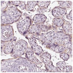 KRTAP2-4 Antibody, Novus Biologicals:Antibodies:Primary Antibodies