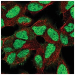 Ku80/XRCC5 Antibody, Novus Biologicals 25 &mu;L; Unconjugated:Antibodies,