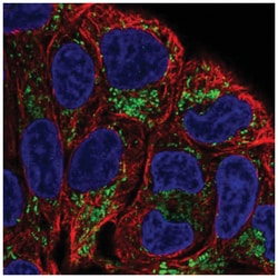 L2HGDH Antibody, Novus Biologicals:Antibodies:Primary Antibodies