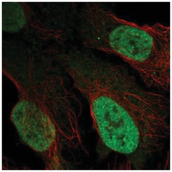 LAF4 Antibody, Novus Biologicals:Antibodies:Primary Antibodies