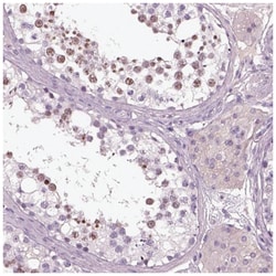 Lambda5/IGLL1 Antibody, Novus Biologicals:Antibodies:Primary Antibodies