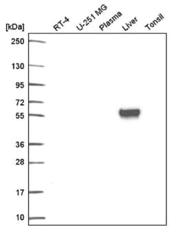 Lamin B Receptor Antibody, Novus Biologicals 100&mu;L; Unlabeled:Antibodies,