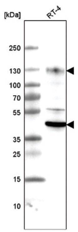 LAMP-1/CD107a Antibody (CL4463), Novus Biologicals 100&mu;L; Unlabeled:Antibodies,