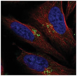 LAPTM4B Antibody, Novus Biologicals 100&mu;L; Unlabeled:Antibodies, Polyclonal