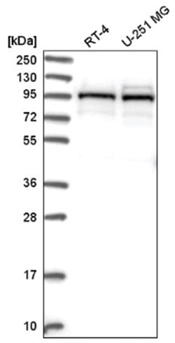 LARP5 Antibody, Novus Biologicals 25 &mu;L:Antibodies, Polyclonal