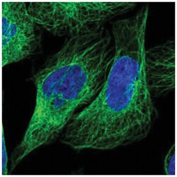 LARP6 Antibody, Novus Biologicals:Antibodies:Primary Antibodies