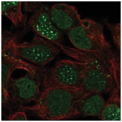 LBX1 Antibody, Novus Biologicals 100&mu;L; Unlabeled:Antibodies, Polyclonal