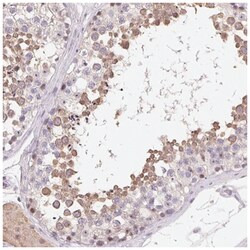 LCA5L Antibody, Novus Biologicals 25 &mu;L, Unlabeled:Antibodies, Polyclonal