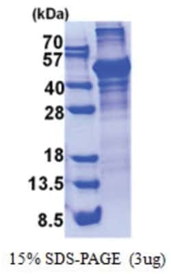 Novus Biologicals Recombinant Human LCAT Protein 100 &mu;g | Buy Online | Novus Biologicals&trade; | Fisher Scientific