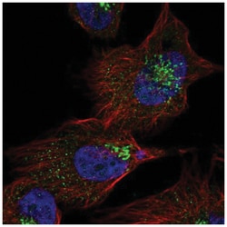 LCHN Antibody, Novus Biologicals 25 &mu;L:Antibodies, Polyclonal