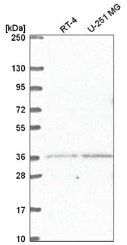 LDB2 Antibody, Novus Biologicals 100&mu;L; Unlabeled:Antibodies, Polyclonal