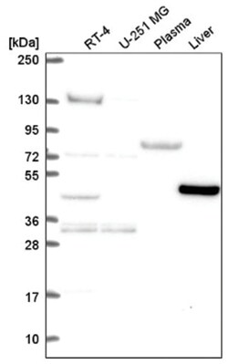 LDHD Antibody, Novus Biologicals 25 &mu;L, Unlabeled:Antibodies, Polyclonal
