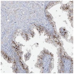 Leptin R Rabbit anti-Human, Polyclonal, Novus Biologicals 0.025mL; Unlabeled:Antibodies,