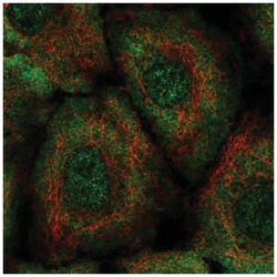 Leukotriene B4 Receptor 2 Antibody, Novus Biologicals 25 &mu;L, Unlabeled:Antibodies,