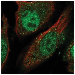 LGSN Antibody, Novus Biologicals:Antibodies:Primary Antibodies
