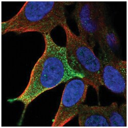 LHFPL3 Antibody, Novus Biologicals 100&mu;L; Unlabeled:Antibodies, Polyclonal