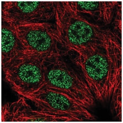 LHX2 Antibody, Novus Biologicals 25 &mu;L:Antibodies, Polyclonal