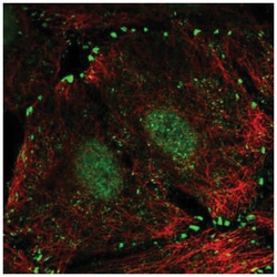 LIMD1 Antibody, Novus Biologicals:Anticuerpos:Anticuerpos primarios
