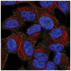 LIMD2 Antibody, Novus Biologicals 100&mu;L; Unlabeled:Antibodies, Polyclonal