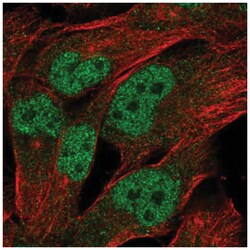 LINC00493 Antibody, Novus Biologicals 25 &mu;L:Antibodies, Polyclonal