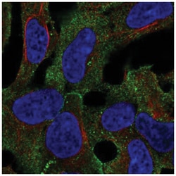 LINGO-1 Antibody, Novus Biologicals 25 &mu;L, Unlabeled:Antibodies, Polyclonal