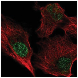 Livin Antibody, Novus Biologicals 25 &mu;L, Unlabeled:Antibodies, Polyclonal