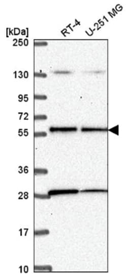 LKB1/STK11 Antibody, Novus Biologicals:Antibodies:Primary Antibodies