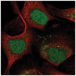 LMO4 Antibody, Novus Biologicals 25 &mu;L, Unlabeled:Antibodies, Polyclonal