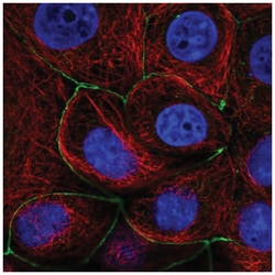 Lnx1 Antibody, Novus Biologicals:Antibodies:Primary Antibodies