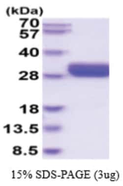 Novus Biologicals Recombinant Human LOX-1/OLR1 Protein 50 &mu;g | Buy Online | Novus Biologicals&trade; | Fisher Scientific