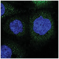 LRCH3 Antibody, Novus Biologicals 25 &mu;L | Buy Online | Novus Biologicals | Fisher Scientific