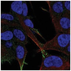 LRFN2 Antibody, Novus Biologicals 25 &mu;L, Unlabeled:Antibodies, Polyclonal