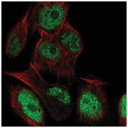 LRRC28 Antibody, Novus Biologicals 100&mu;L; Unlabeled:Antibodies, Polyclonal