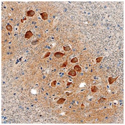Human LRRC3 Antibody, R D Systems:Antibodies:Primary Antibodies