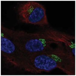 LRRC43 Antibody, Novus Biologicals 25 &mu;L:Antibodies, Polyclonal