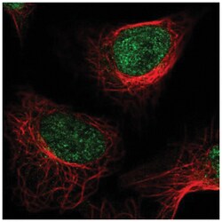 LSD1 Antibody, Novus Biologicals 25 &mu;L, Unlabeled:Antibodies, Polyclonal