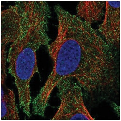 LSP1 Antibody, Novus Biologicals 100&mu;L; Unlabeled:Antibodies, Polyclonal