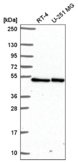 LUC7L Antibody, Novus Biologicals 25 &mu;L, Unlabeled:Antibodies, Polyclonal